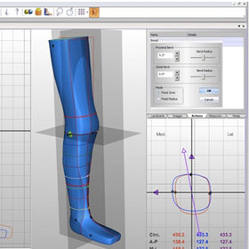 Sanitätshaus Pfänder 3D Technologie Canfit CAD