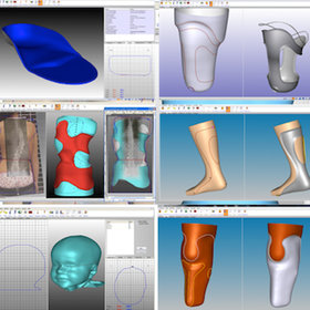 Sanitätshaus Pfänder 3D Technologie Canfit CAD